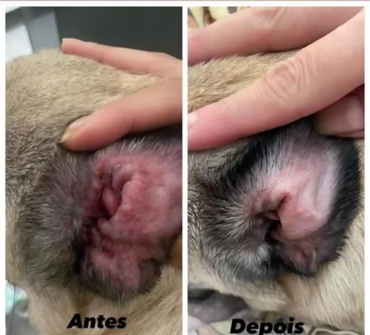 Transformação real - Dermatite no pescoço completamente curada